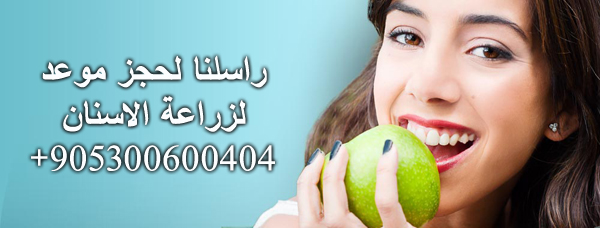 زراعة الاسنان في تركيا Dental Implants in Turkey