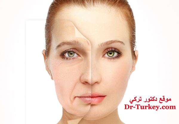 عملية شد الوجه في تركيا