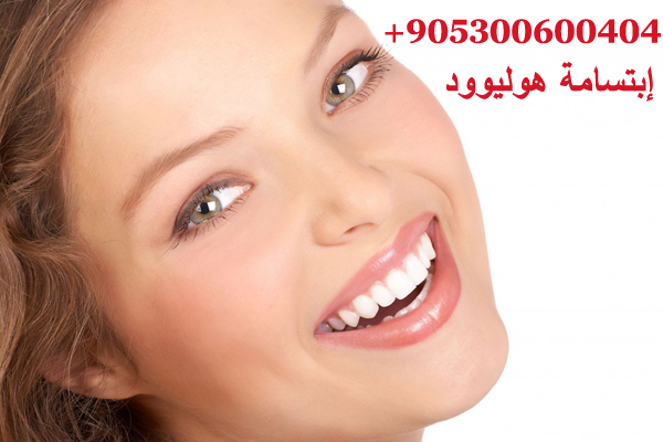 ابتسامة هوليوود سمايل في تركيا
